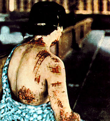 hiroshima victim